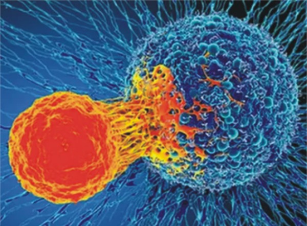 کینسر کی تشخیص اب پیشاب کے نمونوں سے بھی کی جاسکے گی