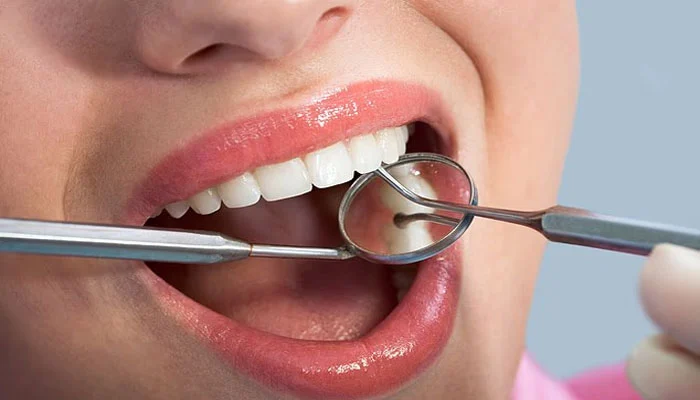 صرف برشنگ دانتوں کی بیماری سے محفوظ رہنے کیلئے کافی نہیں، ماہرین