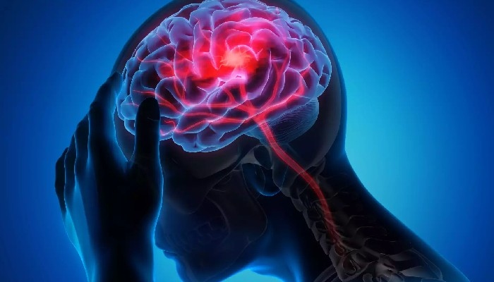 فالج جیسے جان لیوا مرض سے تحفظ فراہم کرنے والی بہترین غذائیں