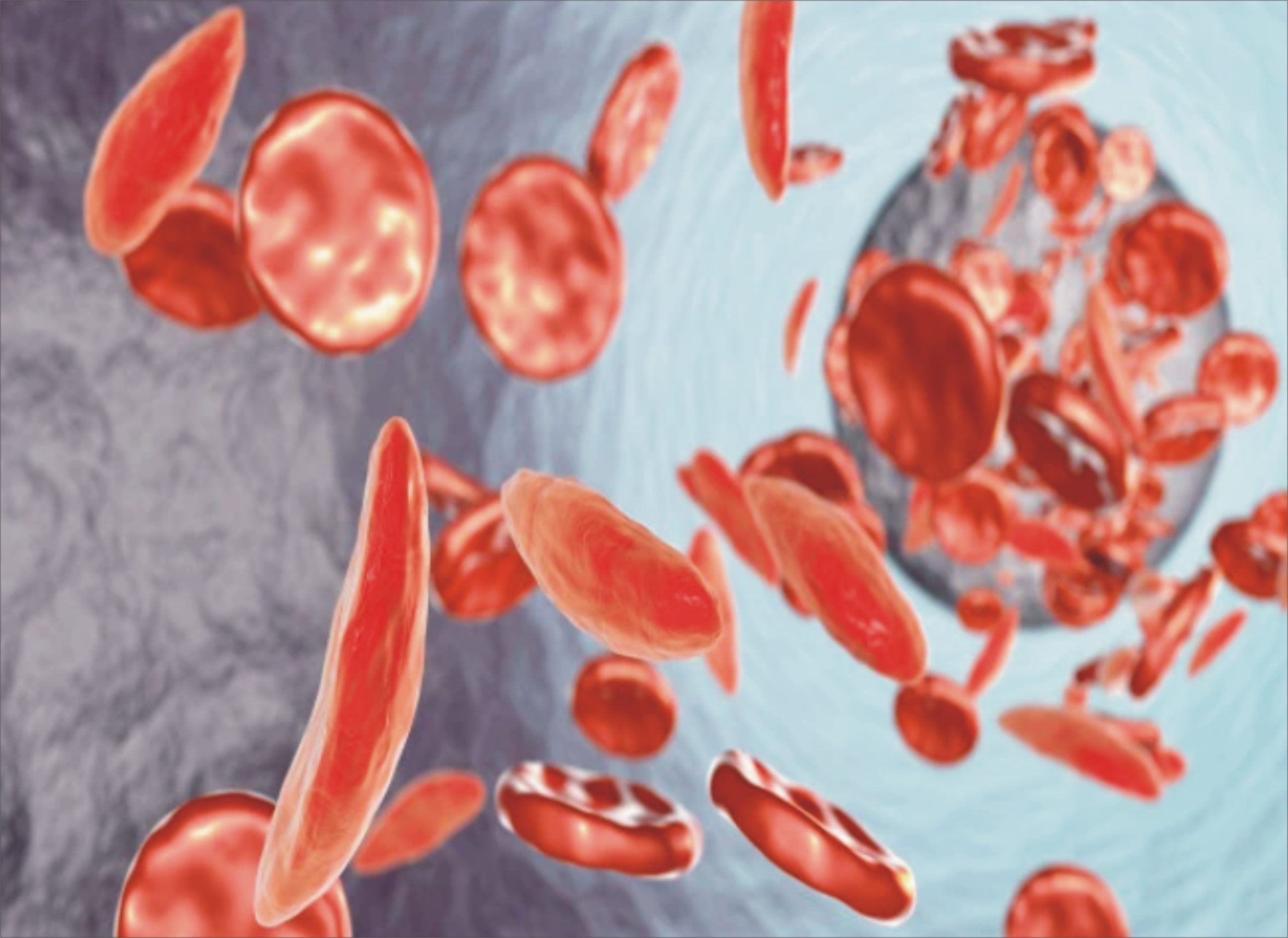 خون کی کمی کی تشخیص اور کینسر کے درمیان تعلق کا انکشاف!