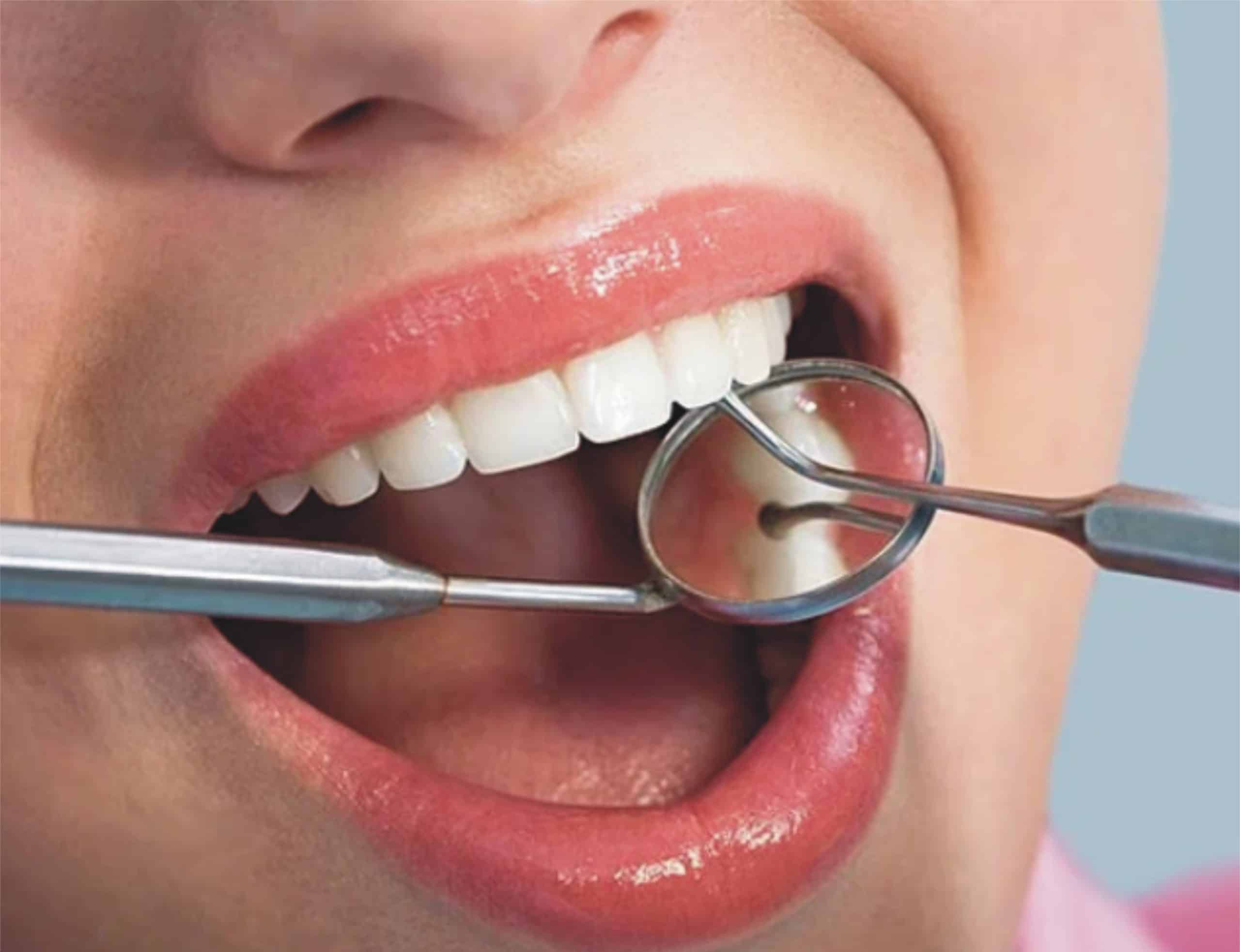 مسوڑھوں سے خون آنا کس خطرناک بیماری کی علامت ہو سکتا ہے؟